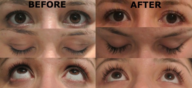 before and after extensions